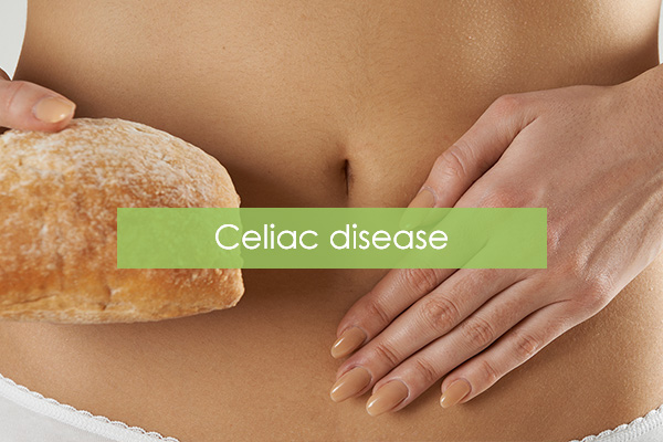 Κοιλιοκάκη